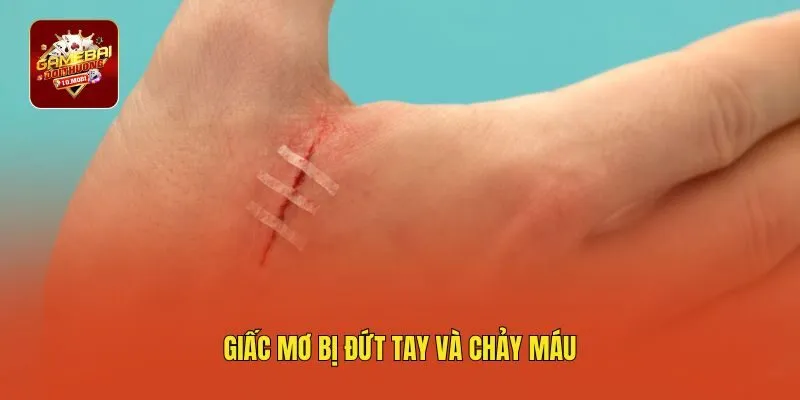 Giấc mơ bị đứt tay và chảy máu
